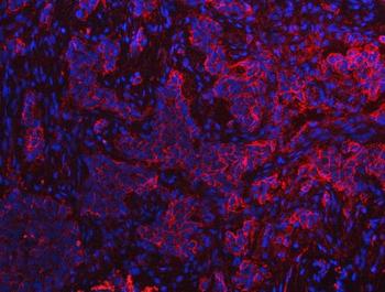 S100A10 Antibody