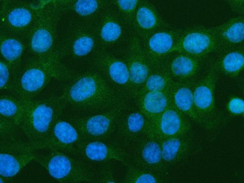 S100A10 Antibody