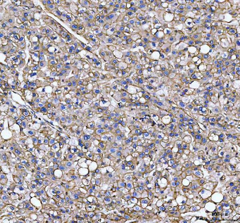 S100A10 Antibody