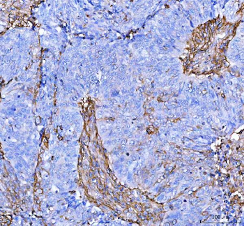 S100A10 Antibody