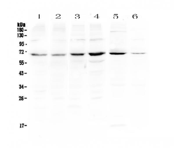 PIAS3 Rabbit Polyclonal Antibody
