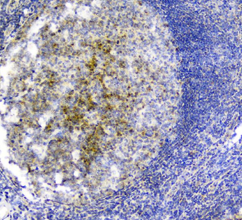 PLK2 Rabbit Polyclonal Antibody