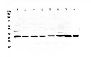 Thrombopoietin/THPO Rabbit Polyclonal Antibody