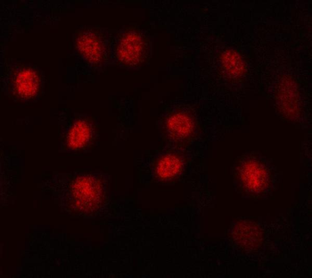MAX Rabbit Polyclonal Antibody