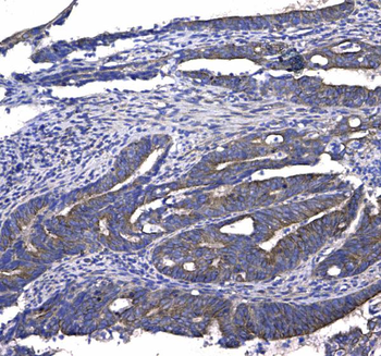 GSTM3 Antibody