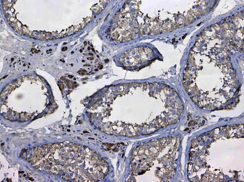 GSTM3 Antibody