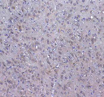GSTM3 Antibody