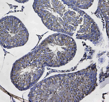 GSTM3 Antibody