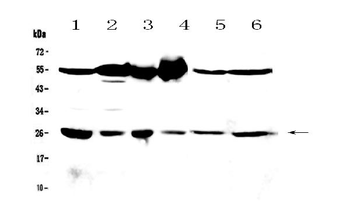 GSTM3 Antibody