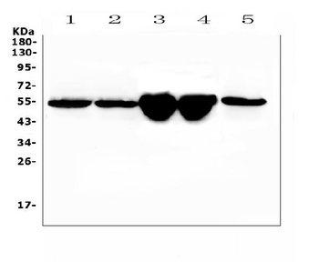 Vitamin D Binding protein/Gc Antibody