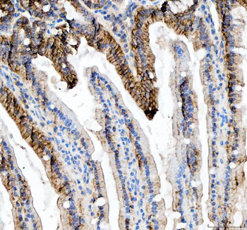 beta Catenin/CTNNB1 Antibody