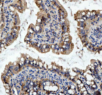 beta Catenin/CTNNB1 Antibody