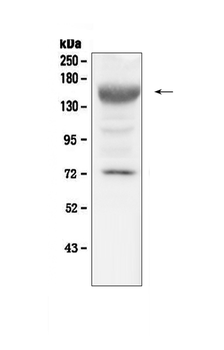 IGF1 Receptor/Igf1r Rabbit Polyclonal Antibody