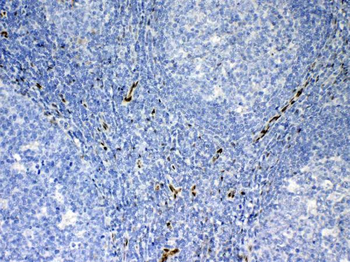 IL33 Rabbit Polyclonal Antibody