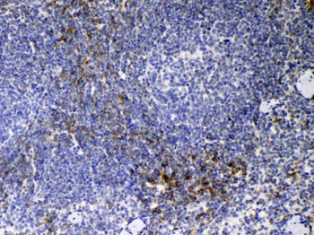 CD14 Rabbit Polyclonal Antibody
