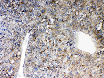 MAVS Rabbit Polyclonal Antibody