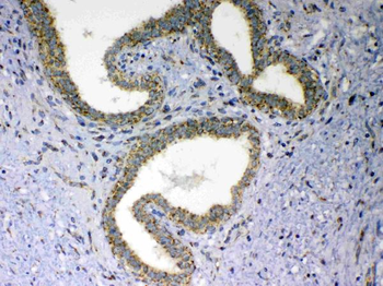 MAVS Rabbit Polyclonal Antibody