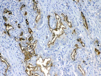 MUC1 Rabbit Polyclonal Antibody