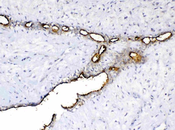 MUC1 Rabbit Polyclonal Antibody