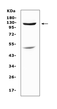MUC1 Rabbit Polyclonal Antibody