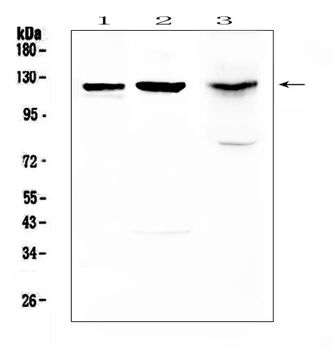 MUC1 Rabbit Polyclonal Antibody