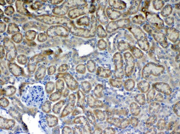 Flt3/CD135 Antibody