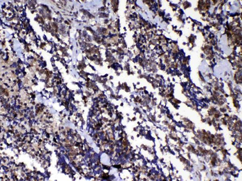 Ran Antibody