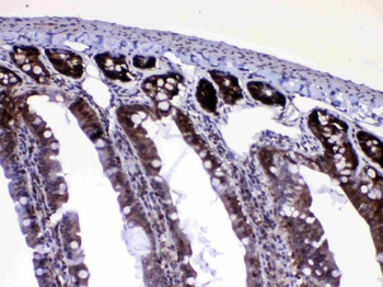 Ran Antibody