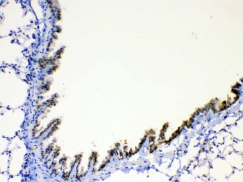 AGRP Rabbit Polyclonal Antibody
