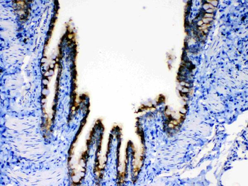 AGRP Rabbit Polyclonal Antibody