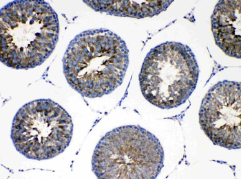 AGRP Rabbit Polyclonal Antibody