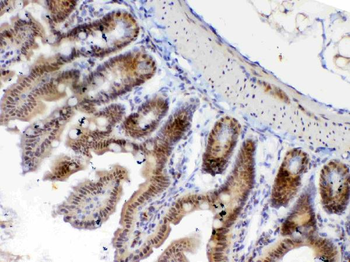 ETV6/Tel Rabbit Polyclonal Antibody
