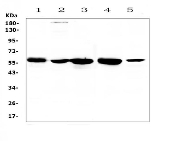 ETV6/Tel Rabbit Polyclonal Antibody