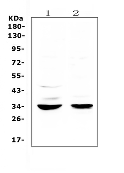 ERCC1 Rabbit Polyclonal Antibody