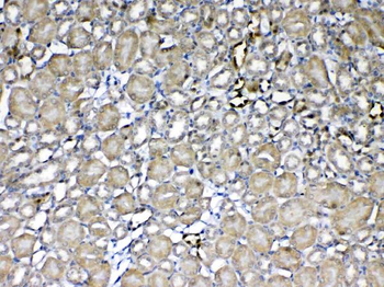 GST3/GST pi/Gstp1 Rabbit Polyclonal Antibody