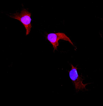 GST3/GST pi/Gstp1 Rabbit Polyclonal Antibody