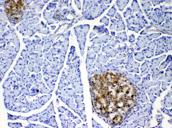 IL17/Il17a Antibody