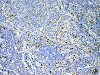 IL17/Il17a Antibody