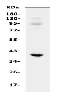 IGFBP3 Rabbit Polyclonal Antibody