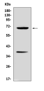 Alpha 1 Fetoprotein/Afp Rabbit Polyclonal Antibody