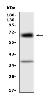Alpha 1 Fetoprotein/Afp Rabbit Polyclonal Antibody