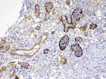 GALE Rabbit Polyclonal Antibody