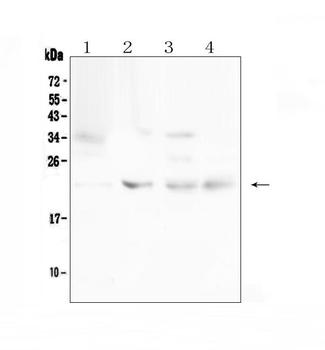 TIMP1 Rabbit Polyclonal Antibody