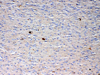 NSF Rabbit Polyclonal Antibody