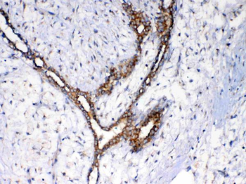 NSF Rabbit Polyclonal Antibody
