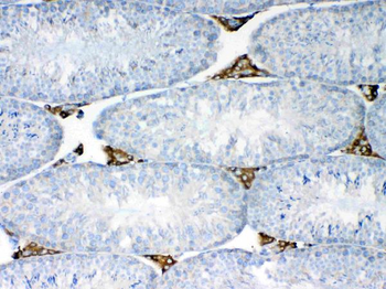 NSF Rabbit Polyclonal Antibody