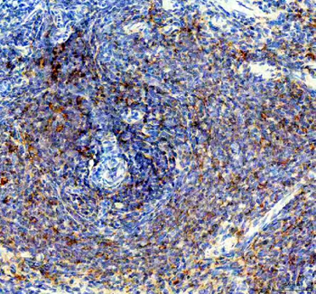 PTP1B/PTPN1 Rabbit Polyclonal Antibody