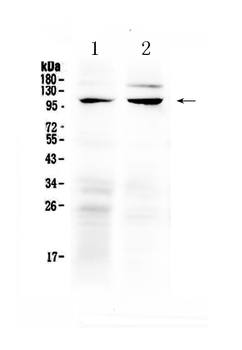 TRPC6 Rabbit Polyclonal Antibody