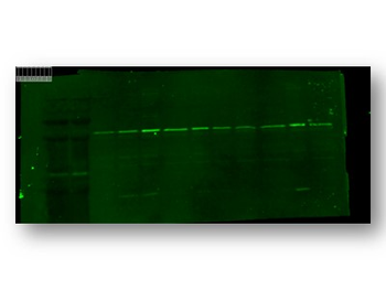 TRPC6 Rabbit Polyclonal Antibody