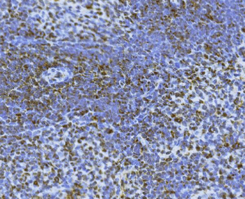 Bid Rabbit Polyclonal Antibody